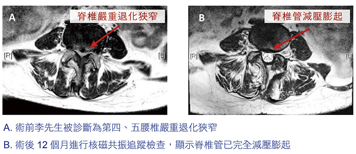 蔡松航醫師及X光片照片組